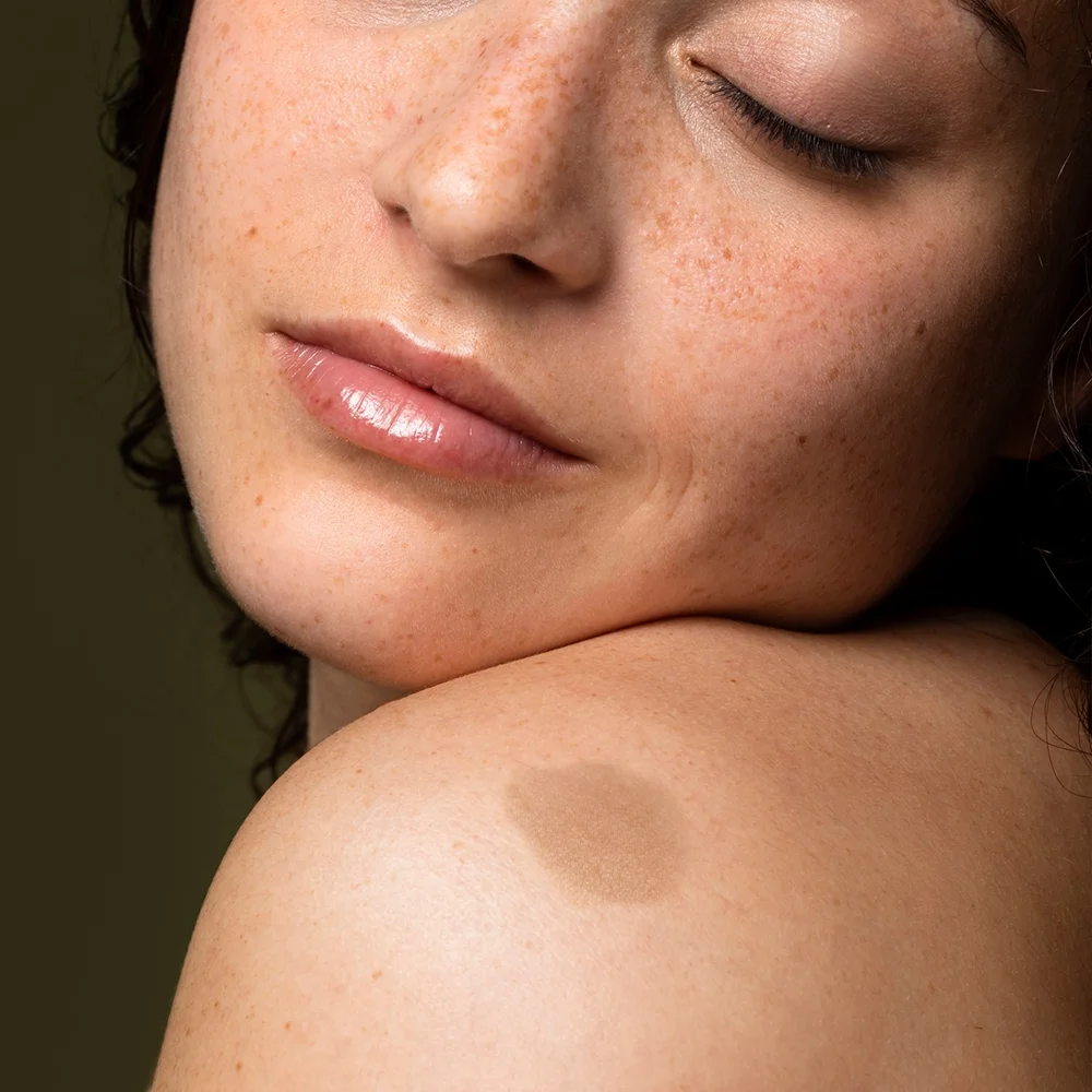 Camuflagem de Mancha e Cicatriz